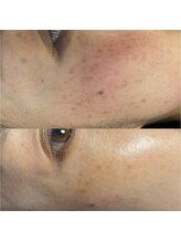 骨盤ダイエットサロン カンフリエ(camphrier)/シミケア