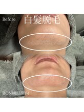 サロンロン 横浜関内(SALON RON)/