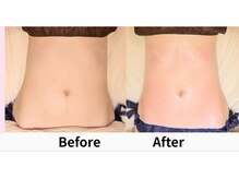 クリア リラクゼーションサロン(Clear)の雰囲気(お腹の浮腫み撃退!スッキリ習慣◎腸が変わればカラダが変わる♪)