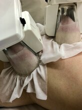 ただマシンを当てるわけではない！ラフレーズこだわり【脂肪冷却】のポイント！