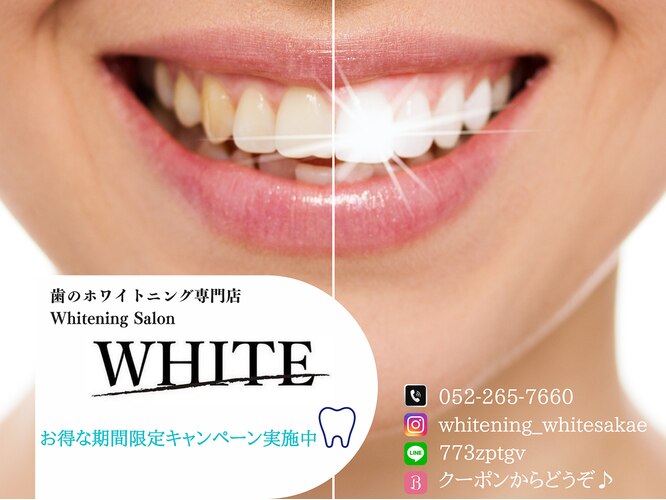 whitening salon WHITE 名古屋栄店【ホワイトニングサロン ホワイト】