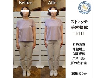 RKY/垂れバスト&O脚&肩の左右差