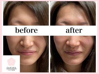 サクラ 伊勢原店(SAKURA)/全国的に数少ない美容機器◎