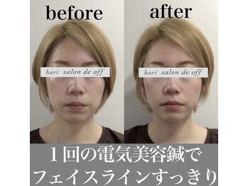 ハリサロンドオフ 心斎橋店(hari salon de off)/フェイスラインの変化♪
