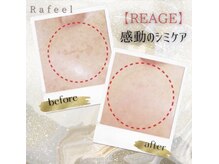 ラフィール/【REAGE】Rafeel しみ改善