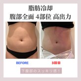 クリーンビューティーメディカルサロン(CLEAN BEAUTY Medical Salon)