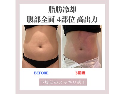 クリーンビューティーメディカルサロン(CLEAN BEAUTY Medical Salon)の写真
