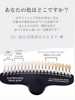ホワイトニングショップ 岸和田店/自分の着色レベルを知ろう！
