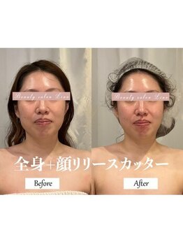 リノ(Lino)/顔リリースカッター◎