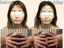 小顔専門サロン[小顔/毛穴/フェイシャル］