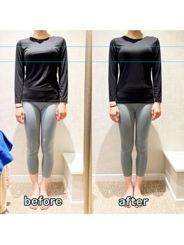 サロン ド エス アオヤマ(SALON DE S AOYAMA)/結果重視!美容骨矯正