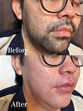 ジョエルワックス 沖縄那覇店(JOELLE WAX)/男性必見！髭お悩み改善！