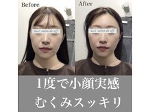 ハリサロンドオフ 心斎橋店(hari salon de off)/お顔全体のむくみがスッキリ！