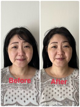 サントーシャ(Santosha)/目がパッチリに♪