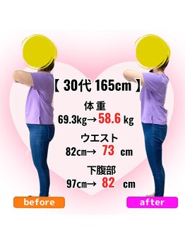 さらさ整骨院/ダイエット整体ビフォーアフター