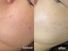 テオリア(TEORIA)/トーンアップ力最強！