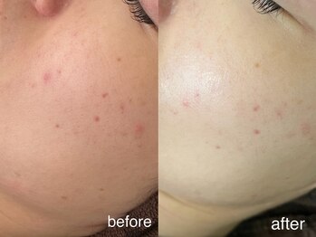 テオリア(TEORIA)/トーンアップ力最強!