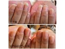 セルフネイルで爪がボロボロに