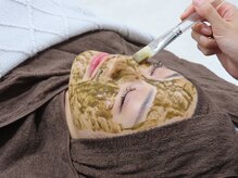 ベル 新潟(Belle)/新潟/ハーブピーリング/毛穴