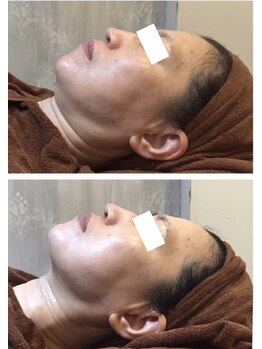 エヴァーグレース 河原町店/京都河原町の毛穴改善美肌サロン