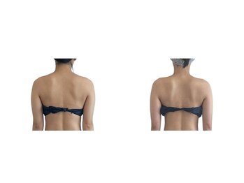 メリア(Mellia)/ブライダルエステ