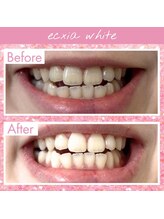 エクシアホワイト SOKA(ecxia white)/