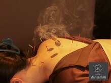 森の鍼灸院 京都下京町家院