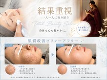 ニコサロン(25salon)