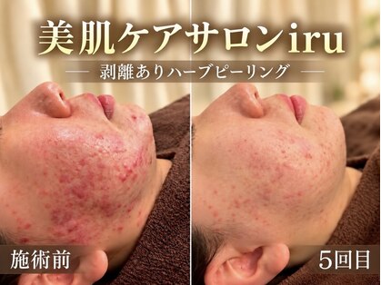 アイル 吉祥寺店(iru)の写真