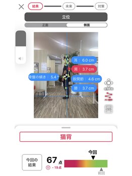 ナオル整体 浦添院(NAORU整体)/AI姿勢診断【側面】