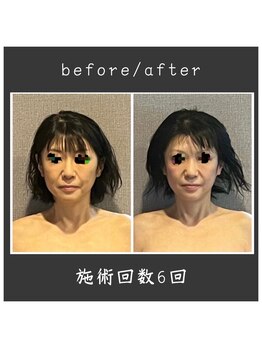 サロン ド ハーモニー美/コルギ♪小顔・たるみ改善等