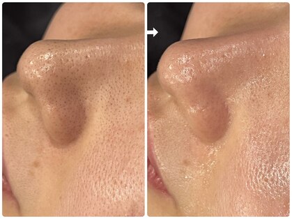 ビースキン(B SKIN)の写真