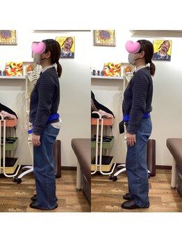 ヒデ整体院(Hide整体院)/猫背矯正骨盤矯正B/A肩こり腰痛