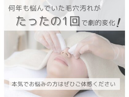 スピカ(spica)の写真