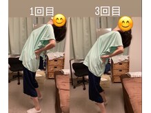たすき鍼灸治療院/反ると腰が痛い