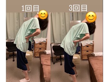 たすき鍼灸治療院/反ると腰が痛い