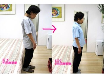 エスコート芦屋サロン/首が落ちて、前がむけない