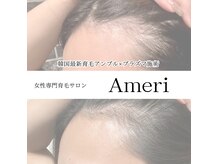 アメリ(Ameri)
