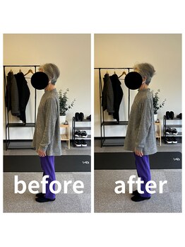 熊本カワル整体 JR上熊本駅院/猫背