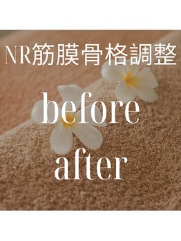 リラクゼーションサロン ラキ(laki)/NR(痩身/肩こり/骨格調整/腰痛)