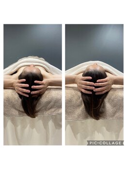 ルナリア ルクス 志木南口駅前店/驚きのビフォーアフター！小顔！