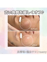 メリー 大和八木店(merry)/気になる毛穴悩みも優しくケア♪