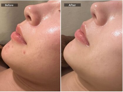 フラーブ(Flourb)の写真