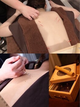 最終形美の写真/1度で感動！本場中国での経験を生かした本格鍼灸施術◆首肩こりを根本改善！全身調整コ-ス60分¥9500→¥4750