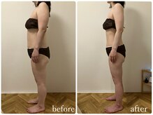 リリィブラン(Lily branc)/痩身/ダイエット