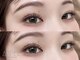 アペル(APPEL)の写真