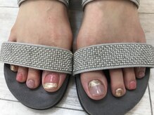 アイコニック ネイルアンドアイ 長久手店(ICONIQ nail&eye)/フットネイル