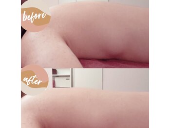 リ ラックス(Re:luxe)/★デスクワークの背中のコリに★