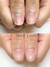 マリーロール 梅田店(Marie Laure)/深爪矯正/自爪育成/自爪風