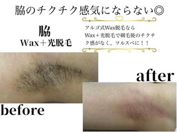 アルゴ 伊勢崎店(ALGO)/アルゴ式WAX脱毛+光脱毛